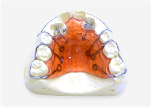 プレートタイプ矯正